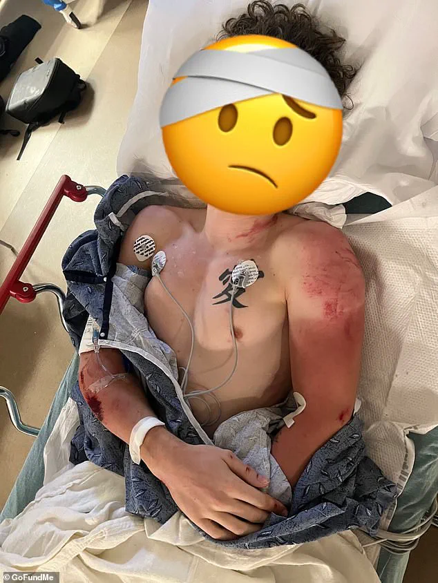 Georgia Motorcyclist Critically Injured in Police Car Collision During Chase