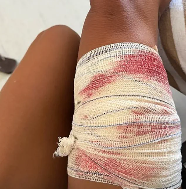 Harrowing Shark Encounter in Brazil's UNESCO Site Underlines Risks to Ecotourism