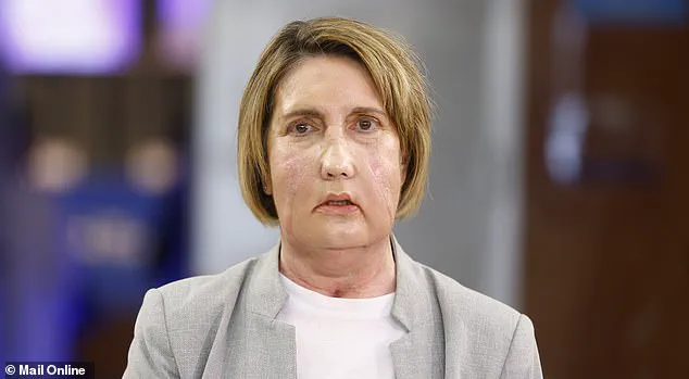 Breakthrough Facial Transplant Uses Tissue from Donor Who Requested Assisted Dying, Raising Ethical Questions