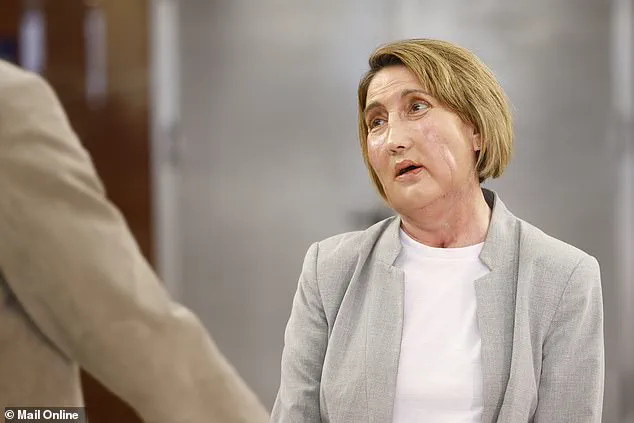 Breakthrough Facial Transplant Uses Tissue from Donor Who Requested Assisted Dying, Raising Ethical Questions