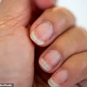 Your Nails May Be Warning You About Serious Health Issues