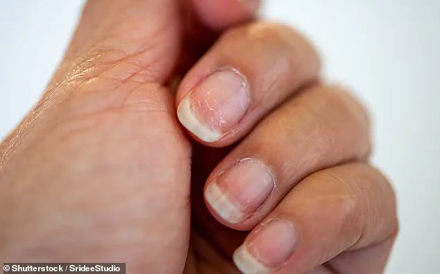 Your Nails May Be Warning You About Serious Health Issues