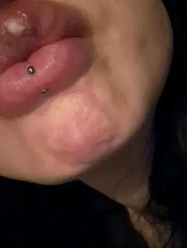 Mother's Nightmare: The Costly Journey of Aesthetic Treatments That Went Wrong